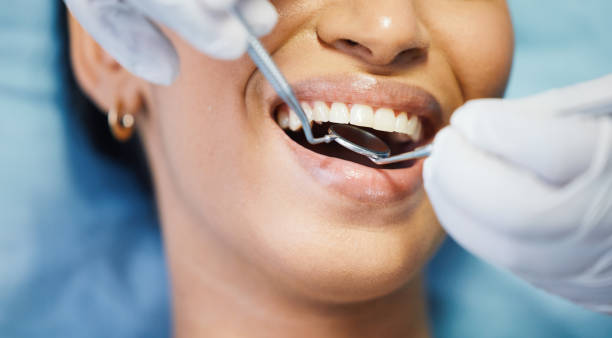 Best Emergency Dental Extractions in Midvale, UT